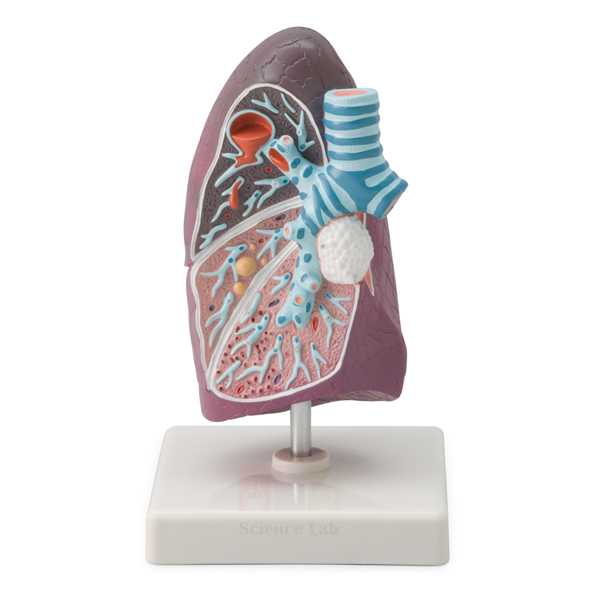 Pathology of the Human Lung Model